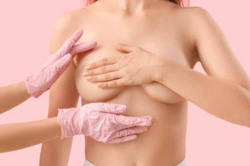 Risultati mastopessi prima e dopo con Dr. Arturo Amoroso Napoli