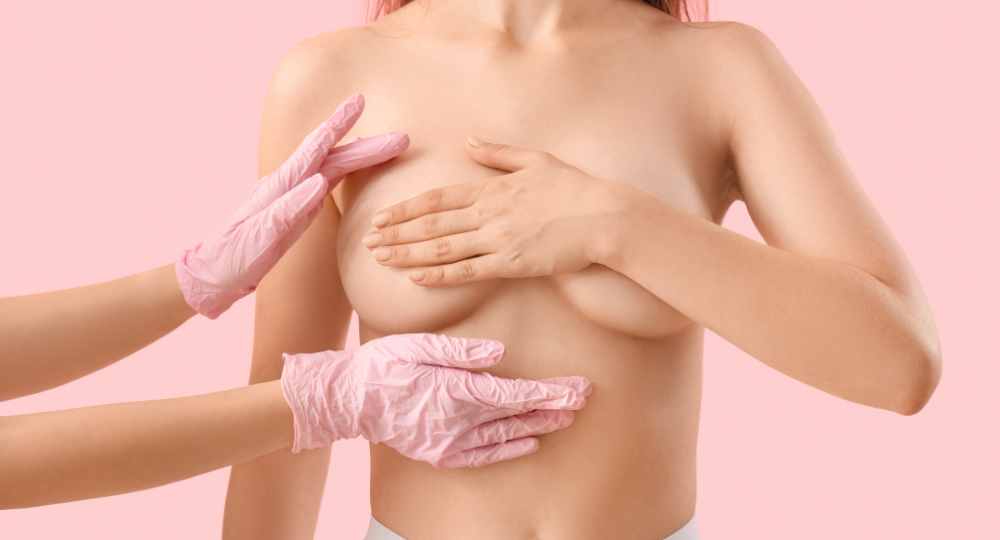 Risultati mastopessi prima e dopo con Dr. Arturo Amoroso Napoli